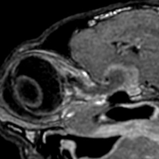 Webinar Brain Nerves 1 - Olfactory, optic and oculomotor nerves - Video registration - Booking NOT YET AVAILABLE