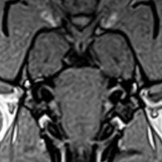 Webinar Brain Nerves 3 - Facial, vestibulocochlear, vagus, glossopharyngeal, accessory, hypoglossus nerves - date to be announced - Booking NOT YET AVAILABLE