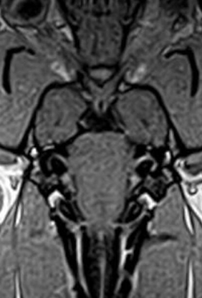 Webinar Brain Nerves 3 - Facial, vestibulocochlear, vagus, glossopharyngeal, accessory, hypoglossus nerves - date to be announced - Booking NOT YET AVAILABLE