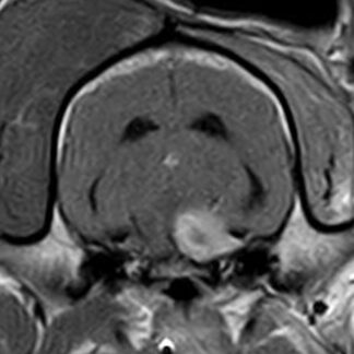 Webinar Brain Nerves 2 - Trochlear, trigeminal and abducens nerves - Video registration - Booking NOT  YET AVAILABLE