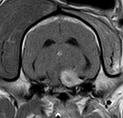 Webinar Brain Nerves 2 - Trochlear, trigeminal and abducens nerves - Video registration - Booking NOT  YET AVAILABLE